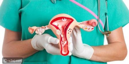 سرطان المبيض.. تعرف على الأسباب والأعراض وطرق العلاج - تكنو بلس