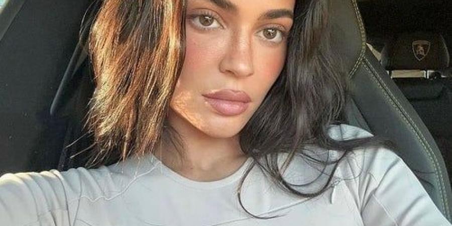 نجمات عالميات دفعهن التنمر إلى عمليات التجميل - تكنو بلس